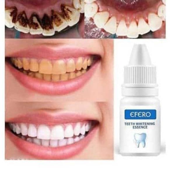 Efero teeth whitening